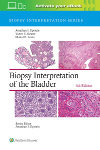 Image of BIOPSY INTERPRETATION OF THE BLADDER